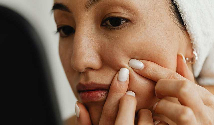 “Breakouts, Be Gone”