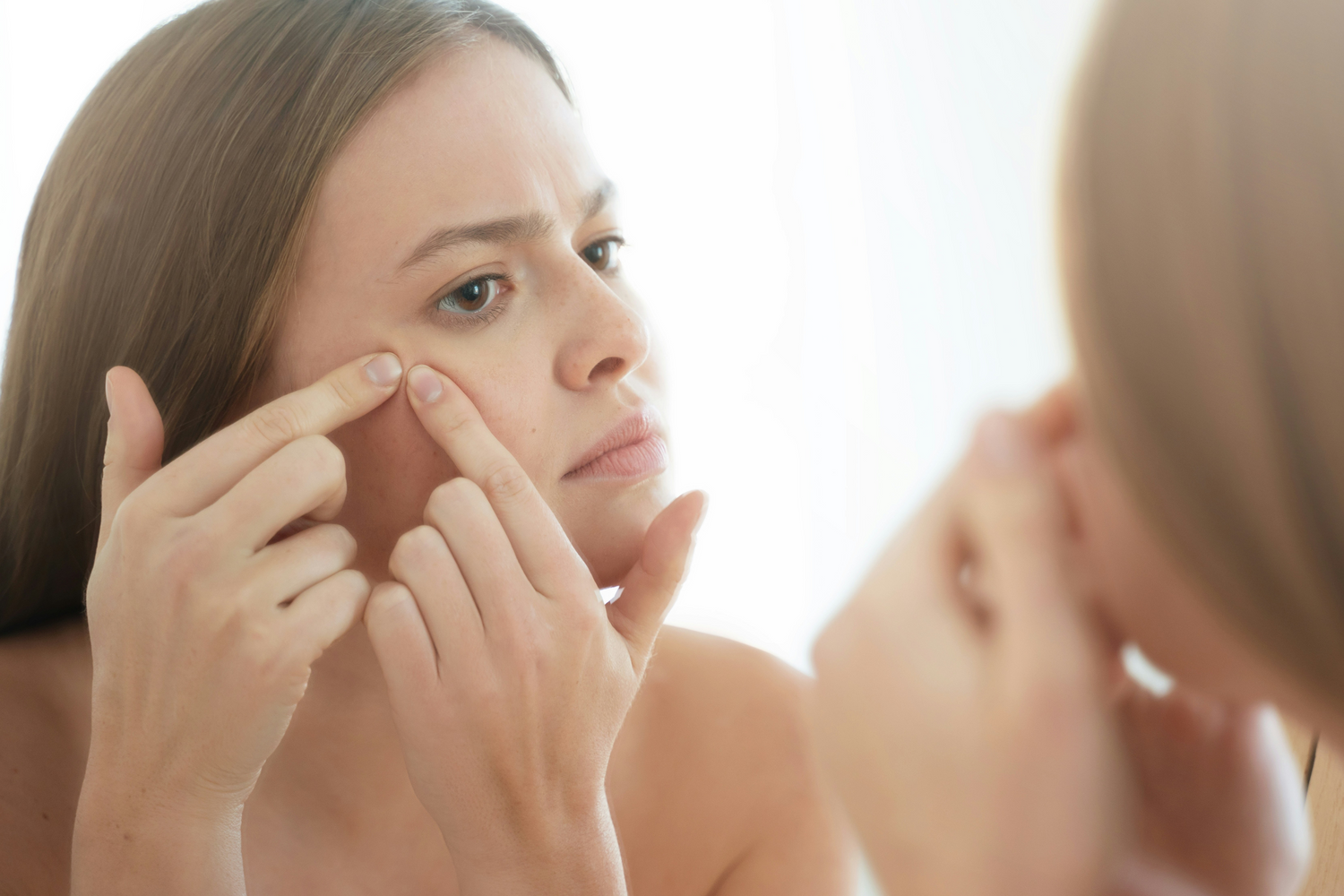 Stop Fighting Your Skin. Start With These Korean Acne Picks.