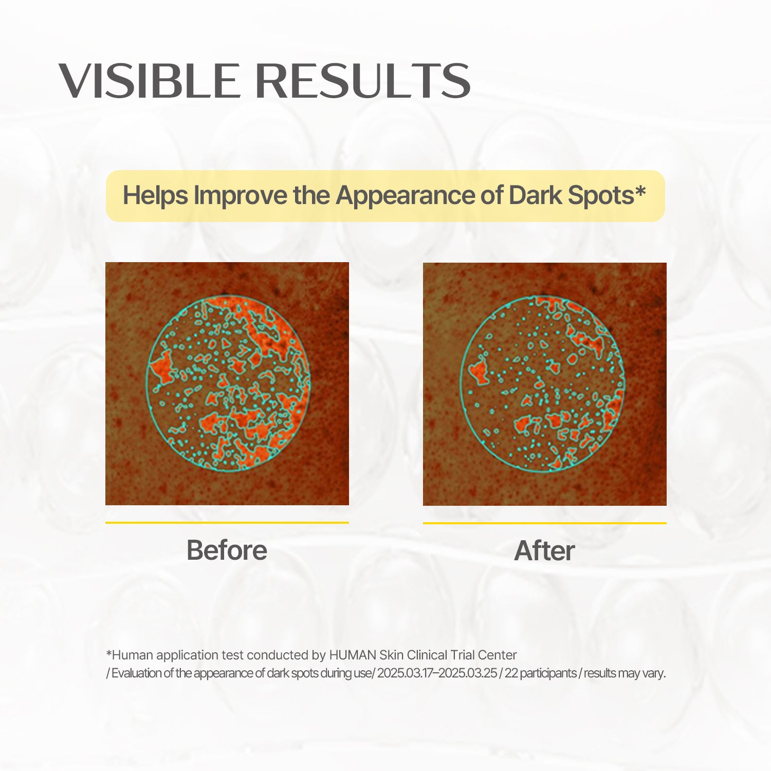 Glutathione Blanc Ampule