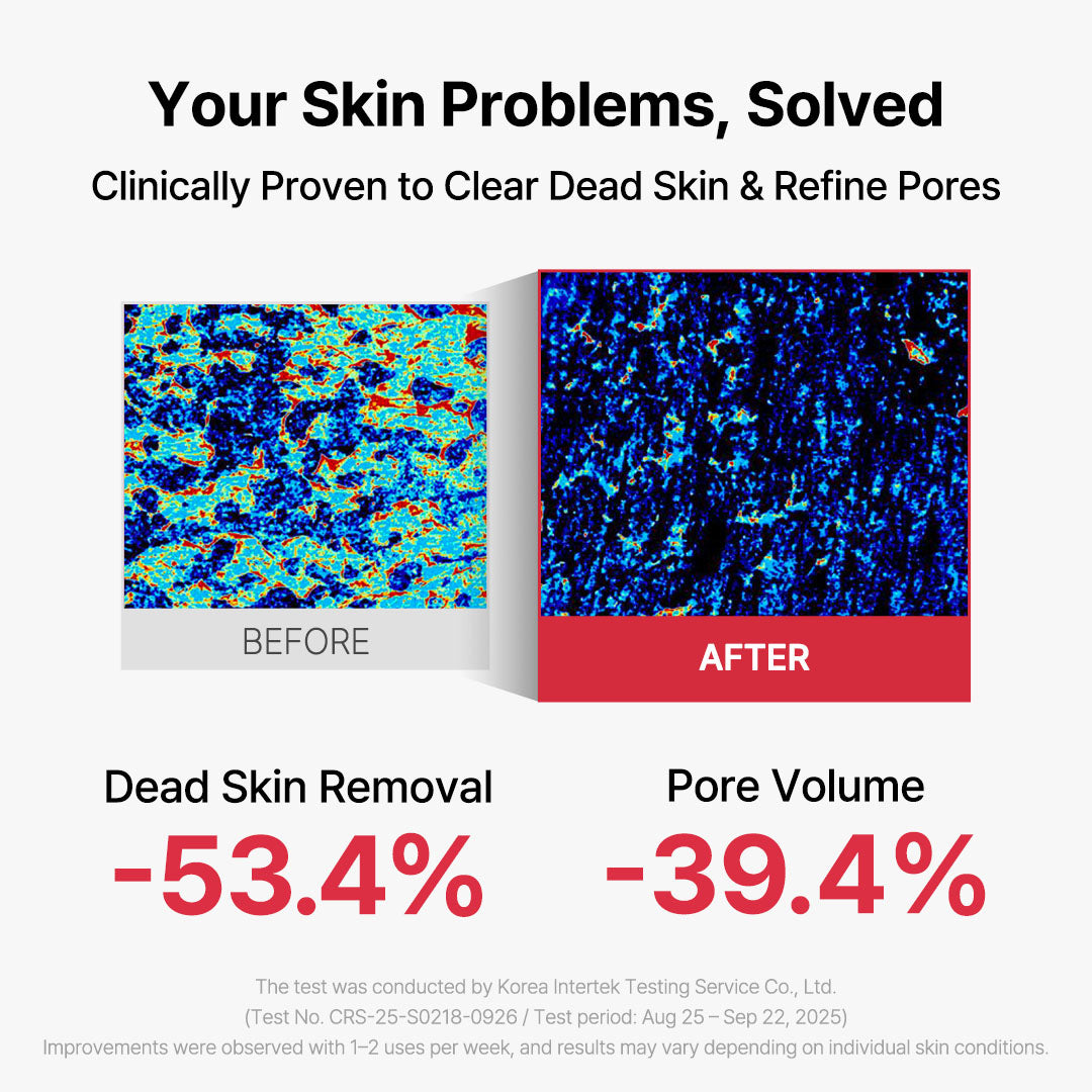 Flash Reset 29 Peeling Mask