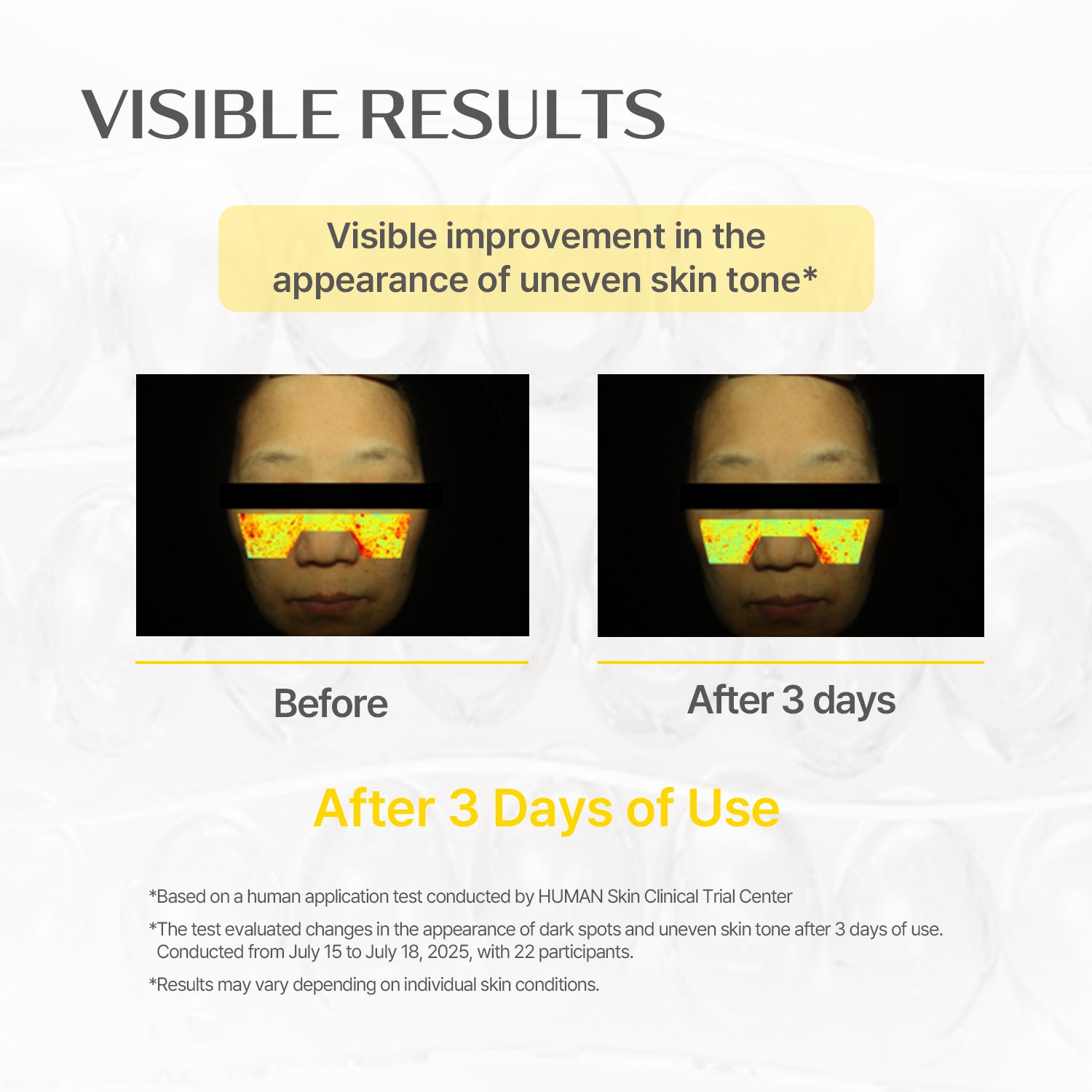 Glutathione Blanc Ampule