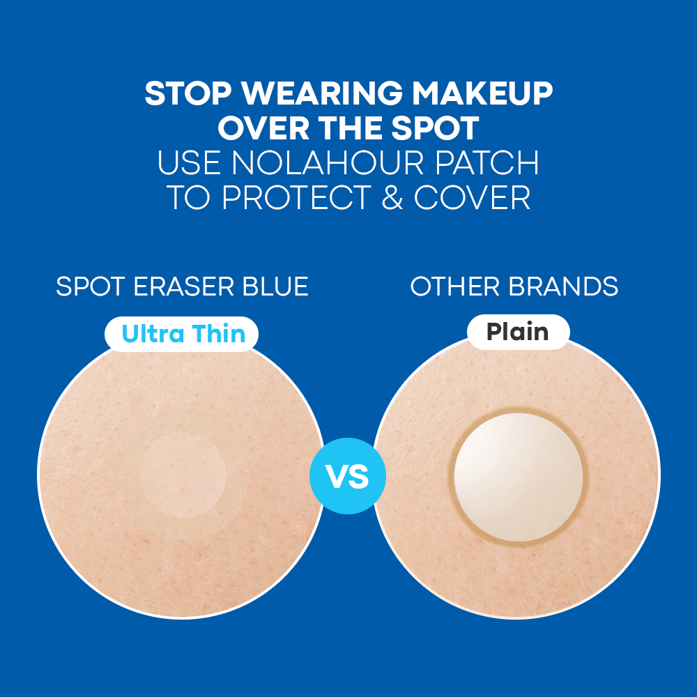 No More Breakouts Set