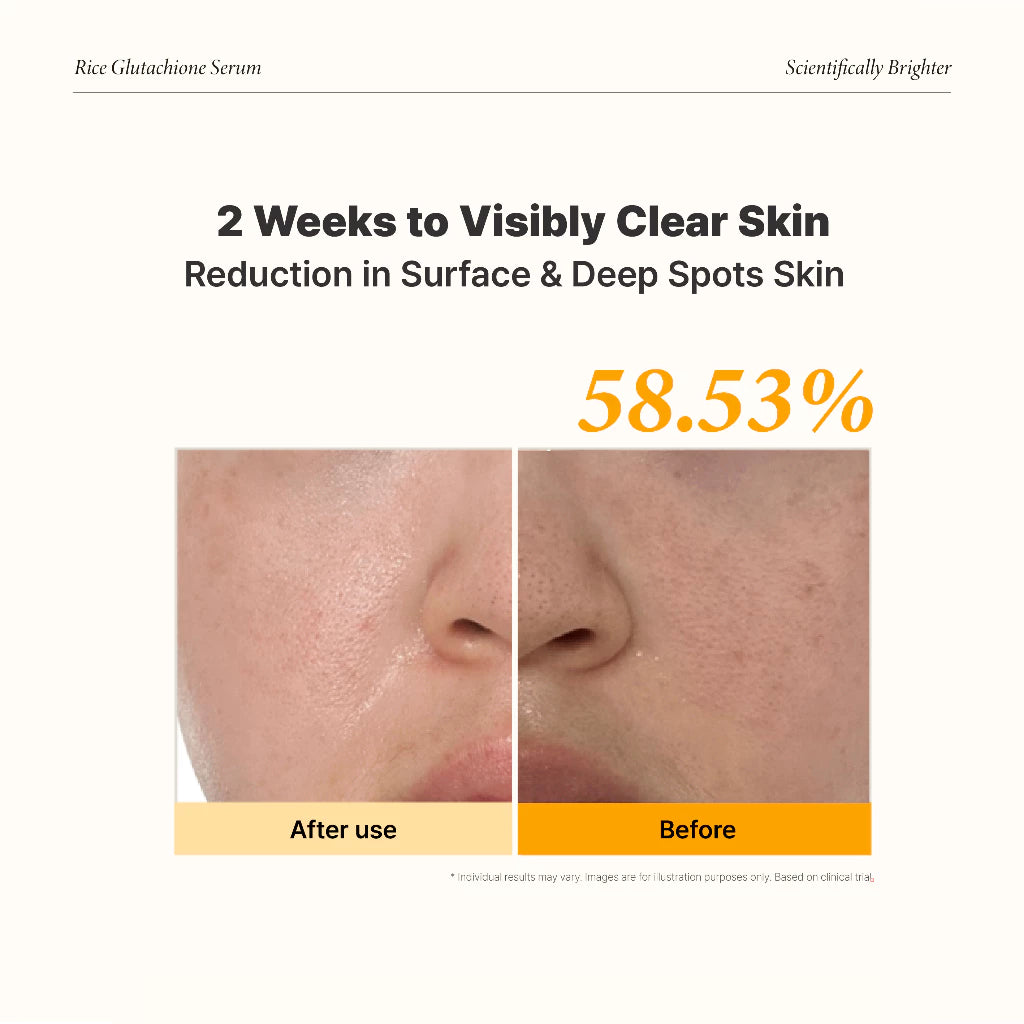 [Chairmane x Nuriglow] Brightening x Lifting Duo