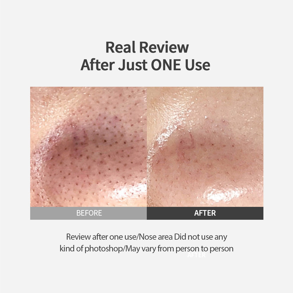 Blackhead Melting Clear Pad