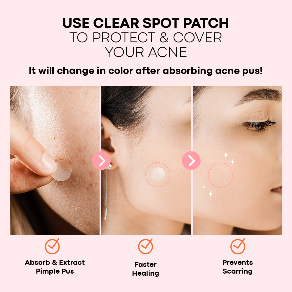 Clear Spot Patch