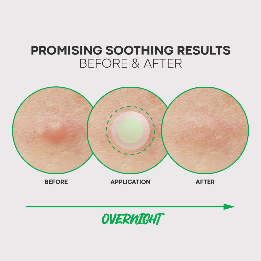 Spot Eraser Green Step 1