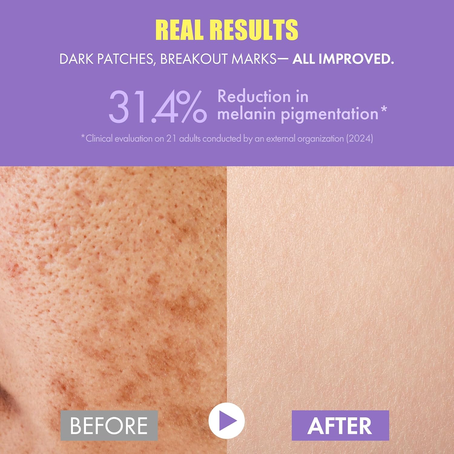 Glutathione Vitamin C Serum