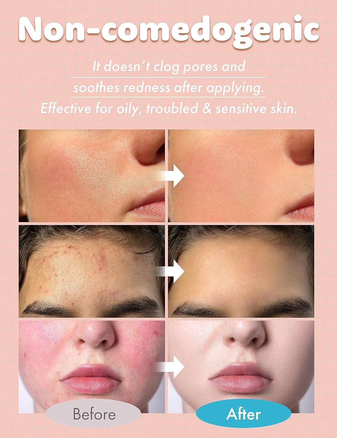 Tea Tree Vitamin Boosting Toner