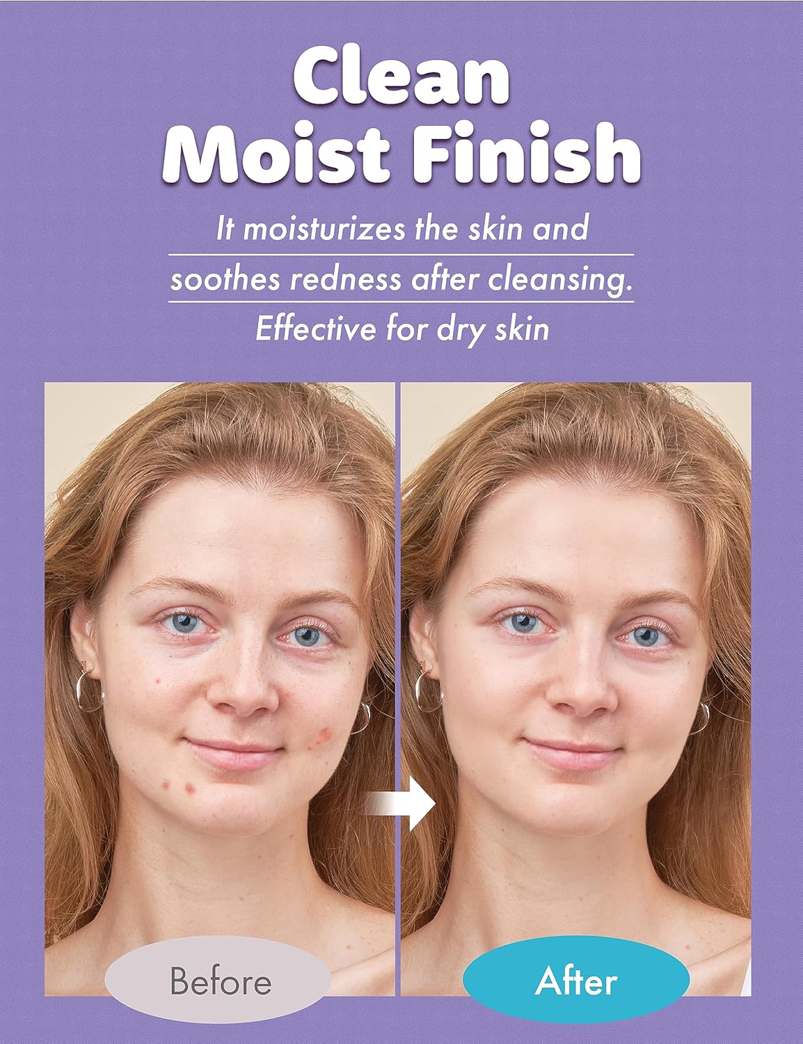 Tea Tree AC care Cleansing Foam