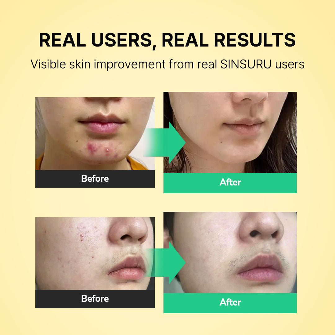 Watery Sulfur 82 Soothing Serum