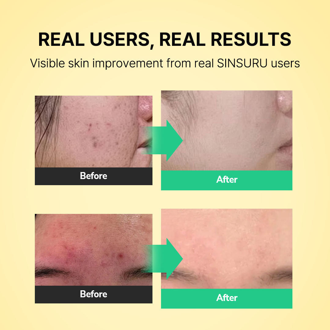 Watery Sulfur Pore Cleansing Powder