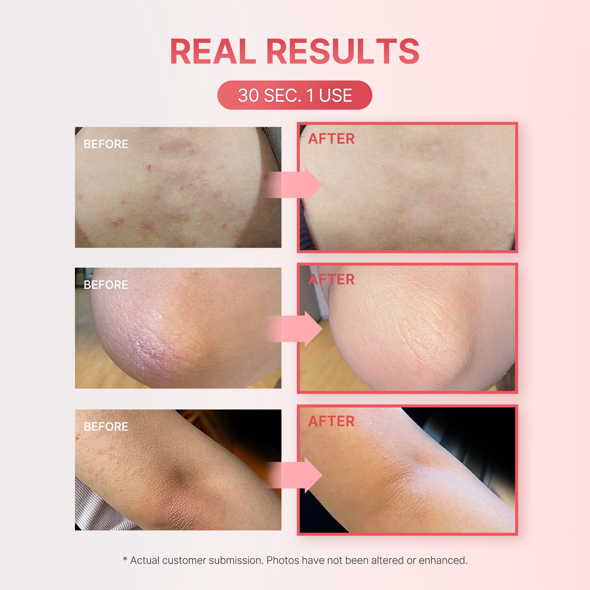 Flash Reset 29 Peeling Mask