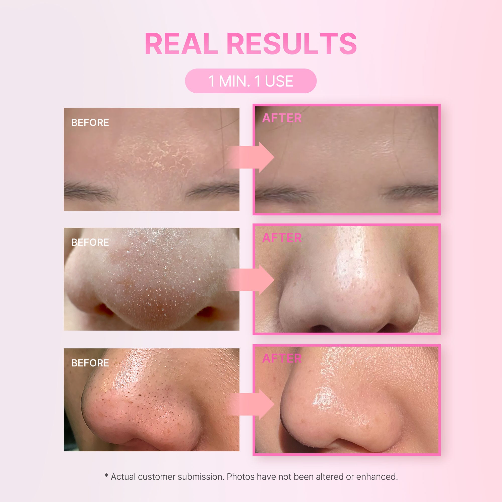 Soft Dewy 9 Peeling Mask
