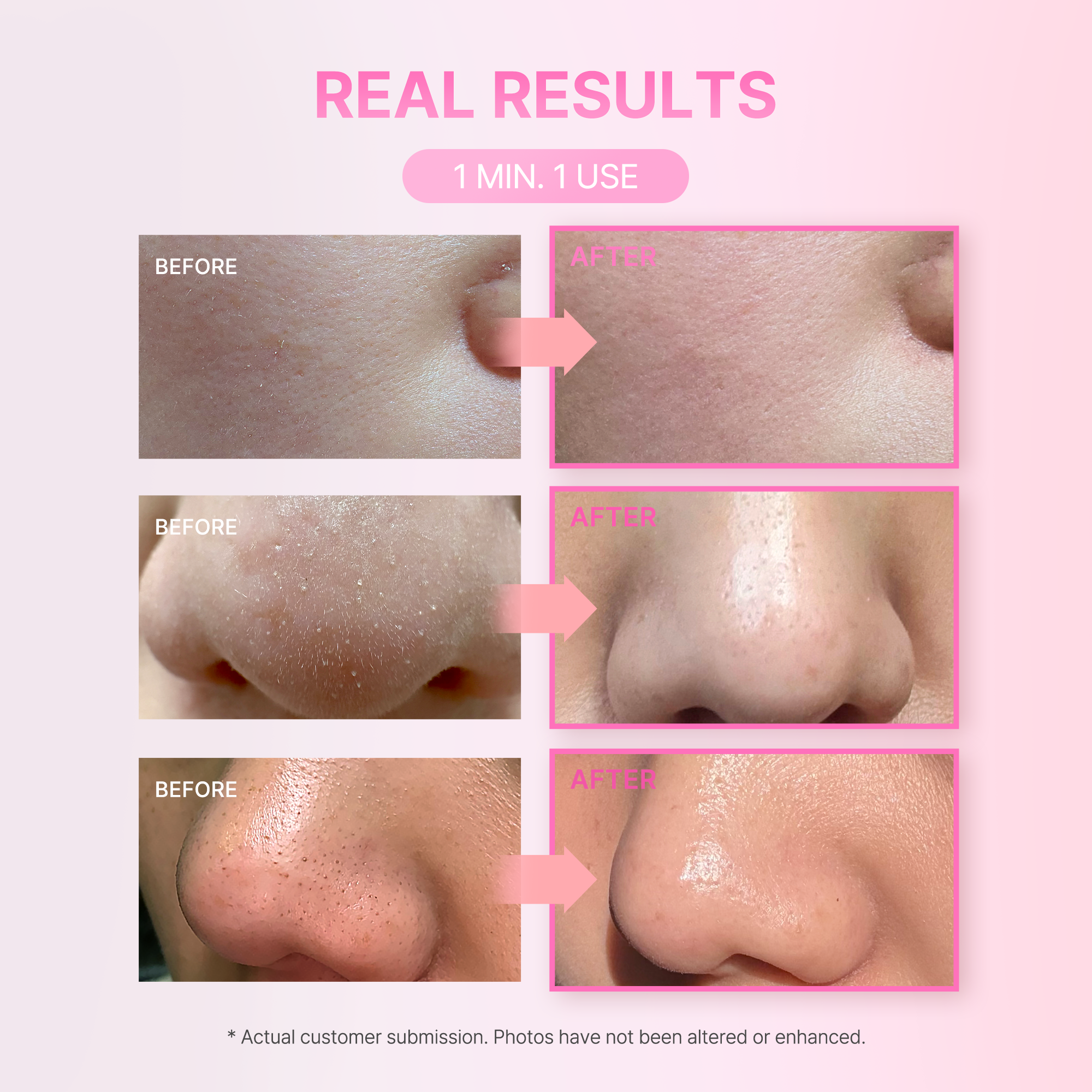 Soft Dewy 9 Peeling Mask